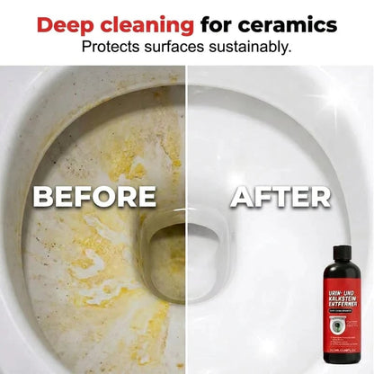💎 Heavy-Duty Toilet Cleaner 🧪 Melts Away Years of Urine Scale & Limescale ✨ No More Scrubbing