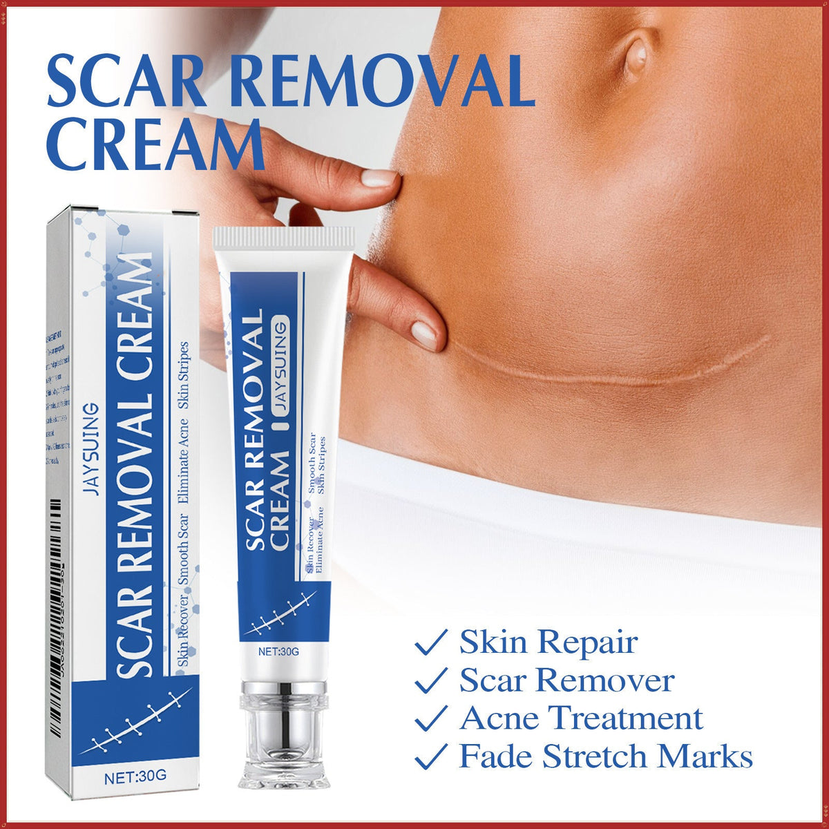 ✨Jaysuing Scar Removal Cream , Skin Repair Gel for Surgical Scars, Acne Marks, Stretch Marks, Burn &amp; Cut Scars, Odorless Skin Care Cream for Adults &amp; Kids