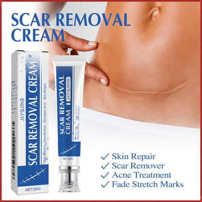 ✨Jaysuing Scar Removal Cream , Skin Repair Gel for Surgical Scars, Acne Marks, Stretch Marks, Burn &amp; Cut Scars, Odorless Skin Care Cream for Adults &amp; Kids