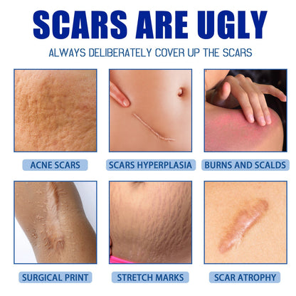 ✨Jaysuing Scar Removal Cream , Skin Repair Gel for Surgical Scars, Acne Marks, Stretch Marks, Burn &amp; Cut Scars, Odorless Skin Care Cream for Adults &amp; Kids