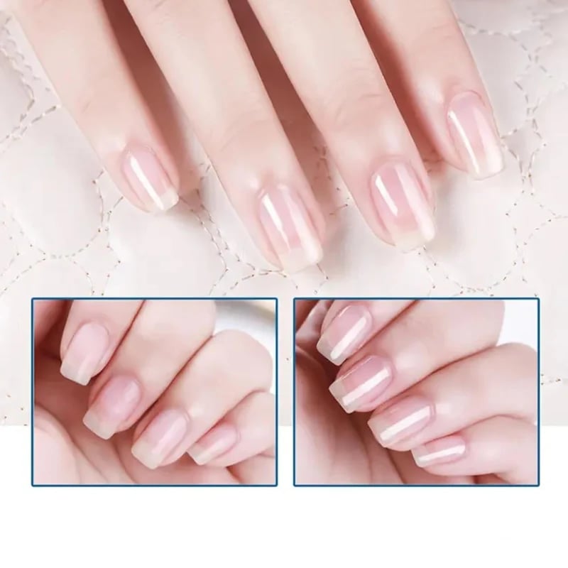 Limited-Time Buy 1 Get 1 Free💕 3 Days Nail Care Formula