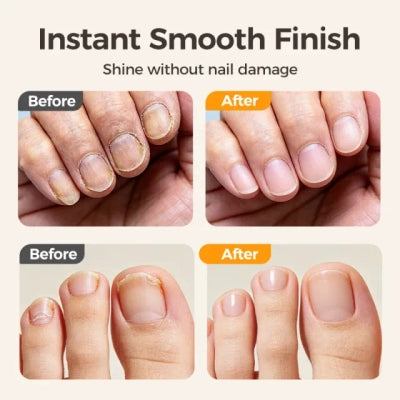 🔥2-in-1 Smart Electric Nail Trimmer u0026 Polisher for All Ages 👨‍👩‍👧‍👦 – Blade-Free, Blood-Free u0026 Stress-Free Nail Care! 💅
